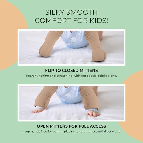 Eczema Scratch Sleeves and Mittens for Babies and Toddlers